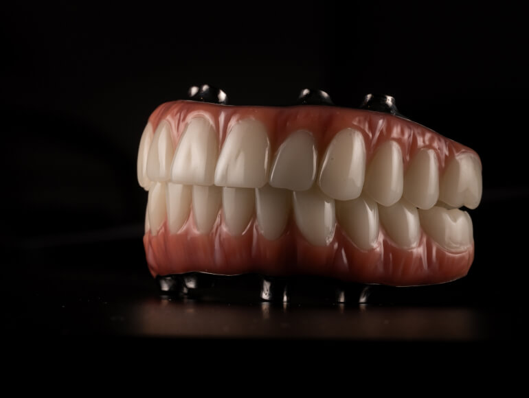 Custom Restoration & Personalized Care