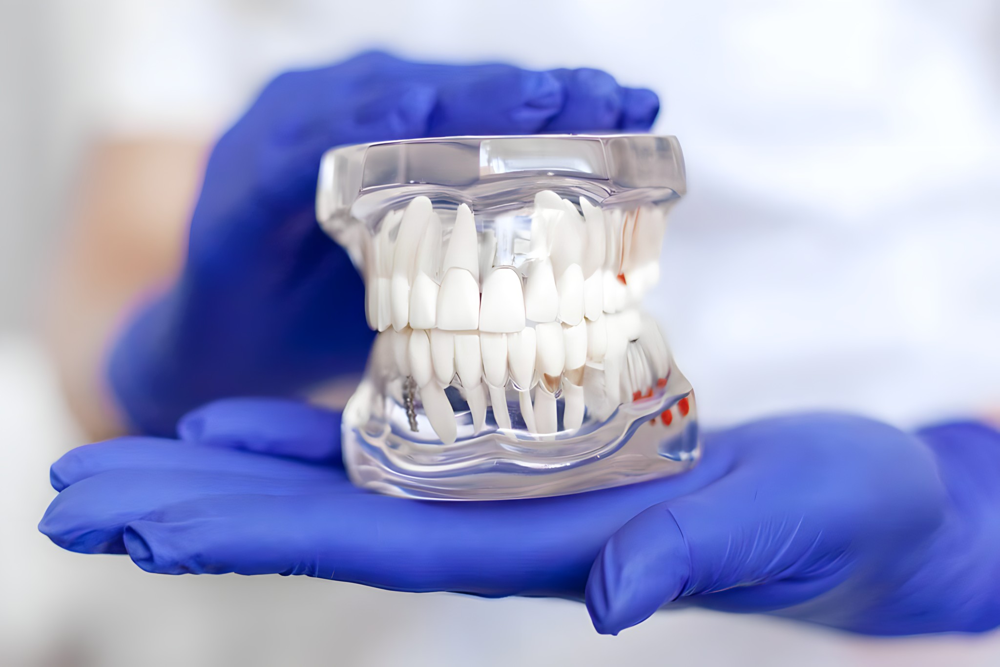 Teeth-In-A-Day Solutions