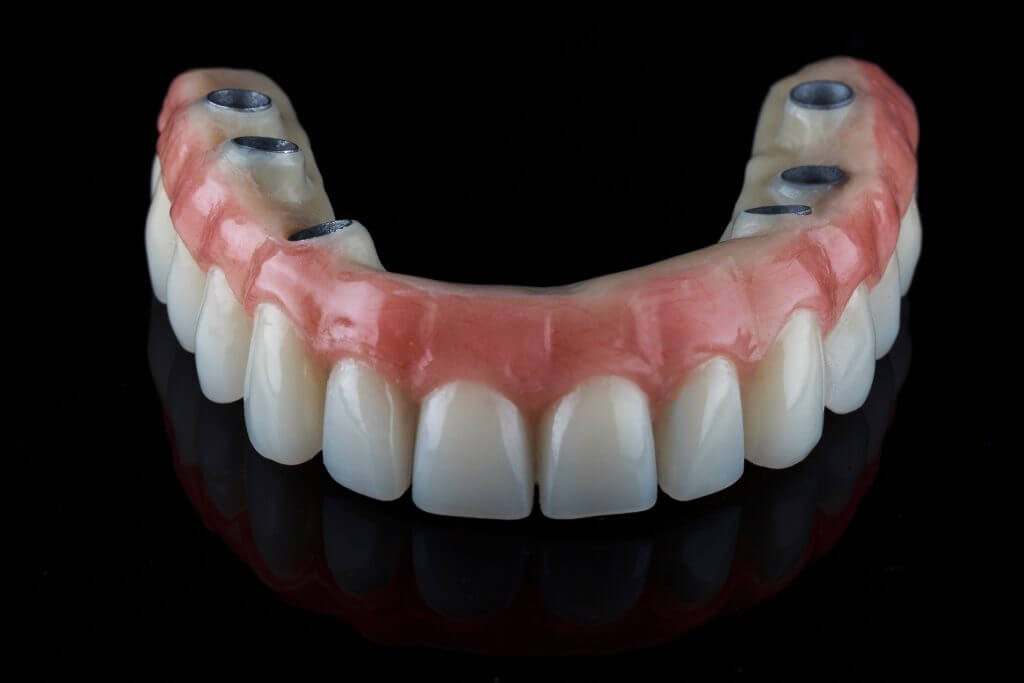 Same-Day Teeth